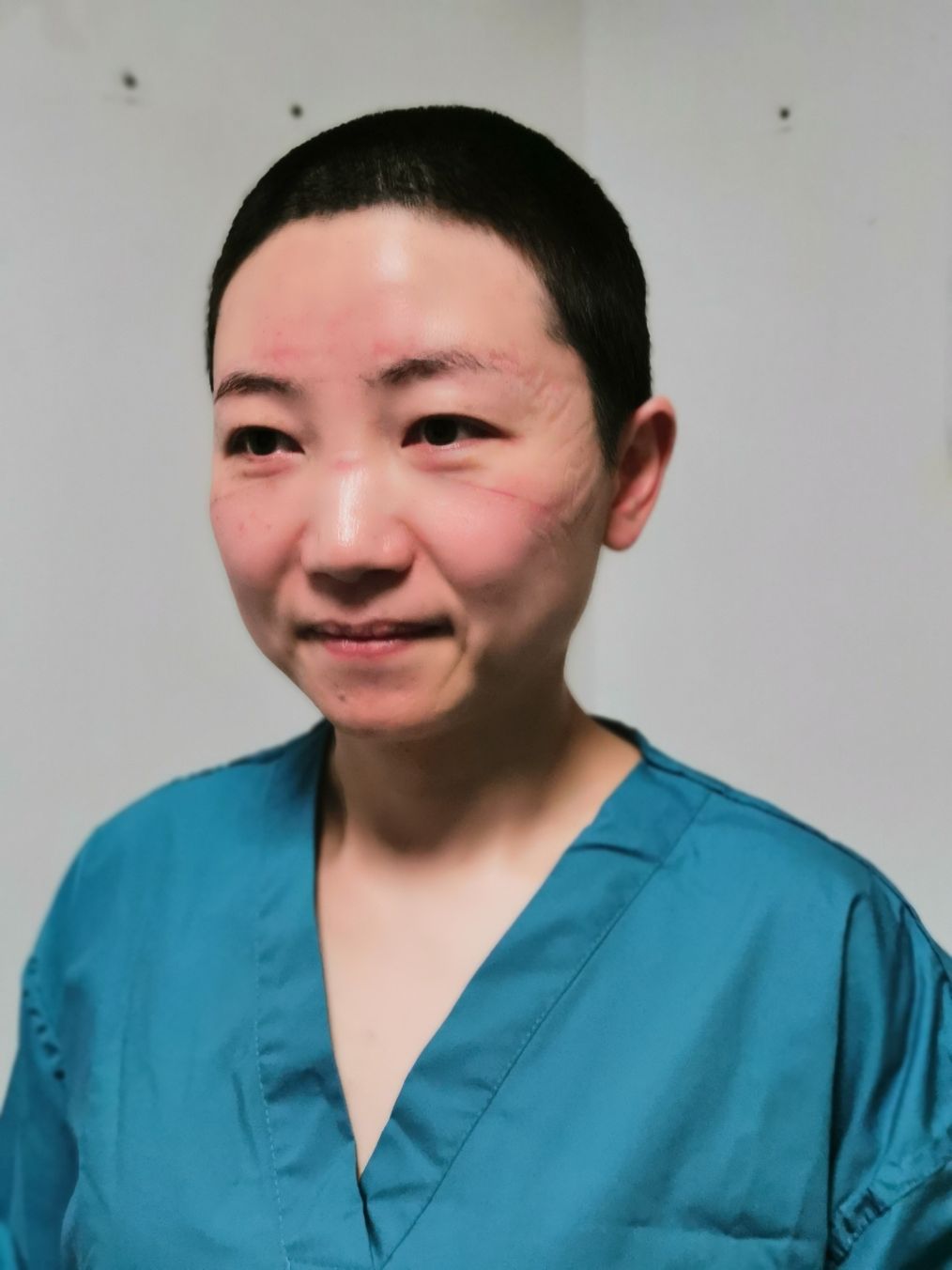 一位青岛护士在武汉的战疫日记:把头发剪了,还给病号理发