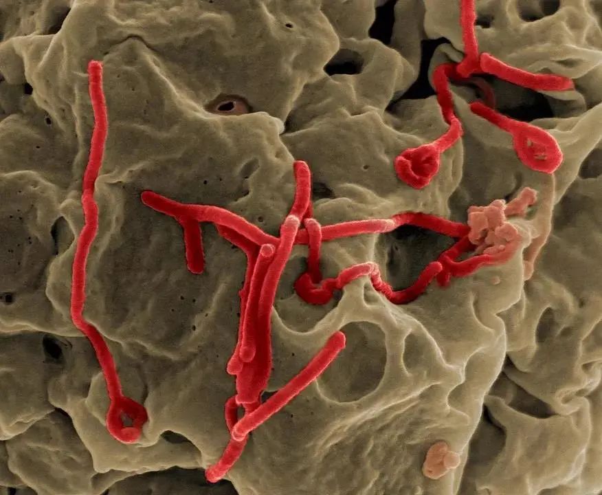 埃博拉病毒吐内脏糜烂图片