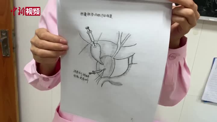 护士手绘100幅儿童手术图 方便给家长讲解