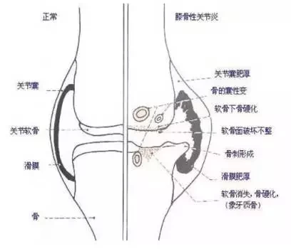 左腿图解结构图图片