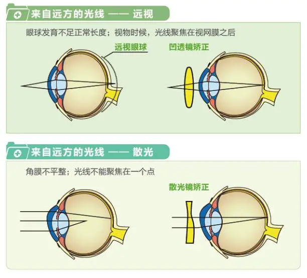 近视远视散光到底是怎么回事