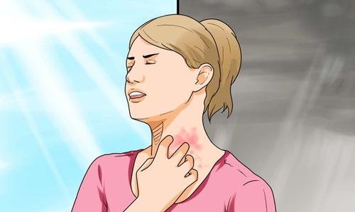 体癣是什么引起的体癣的几个病因浅析