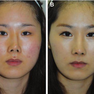 拥有这个特征的人,老了都会和刘嘉玲一样变成牛鼻子?