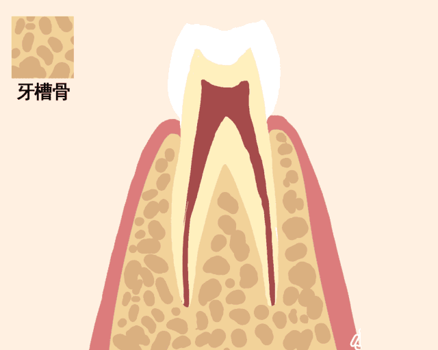 得了牙周炎还不自觉？看看这牙周炎的几大症状，你中了几个？__凤凰网