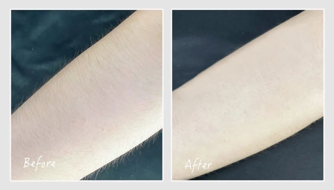 但近看会发现,肌肤表面还留有些许明显的小毛茬.