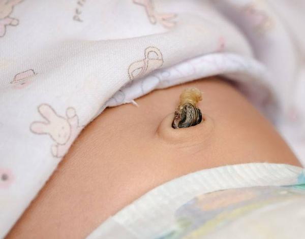 藏在肚脐眼里脏兮兮的东西是什么如果你经常抠该停止了