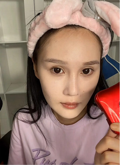 赵本山女儿素颜曝光双眼皮不自然微整后长相与父亲复制粘贴