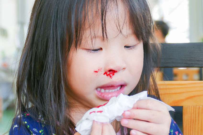 冬季 孩子动不动就流鼻血 4个原因 排在首位孩子经常犯 凤凰网