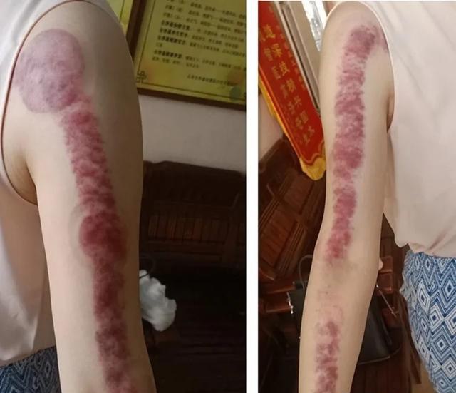 秋季不养肺一年养生全白费那么你知道秋季为何要养肺吗