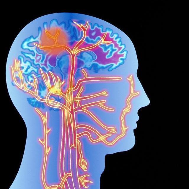 34岁女子脑出血离世提醒身体出现一硬一软尽早就医