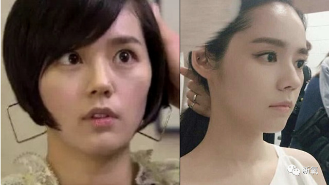 为什么韩佳人每年都在填充,你们却每年都看不出?