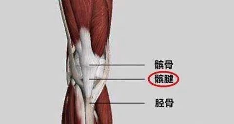 多發生於40歲以上的人群,斷裂位置多在髕骨下極及脛骨結節.