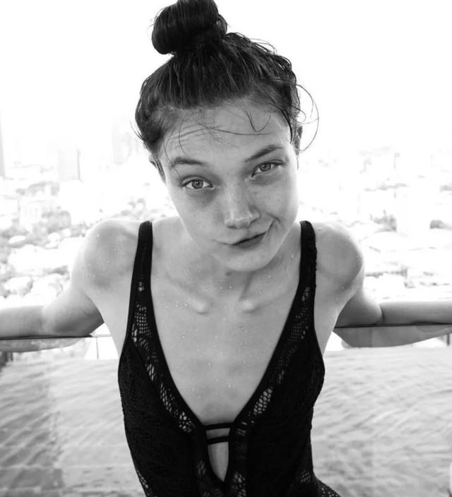 ▼95 后模特混血 yumi lambert 的眼袋,泪沟,看起来像三天没睡觉.