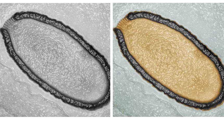 巴西,青藏高原惊现远古病毒.