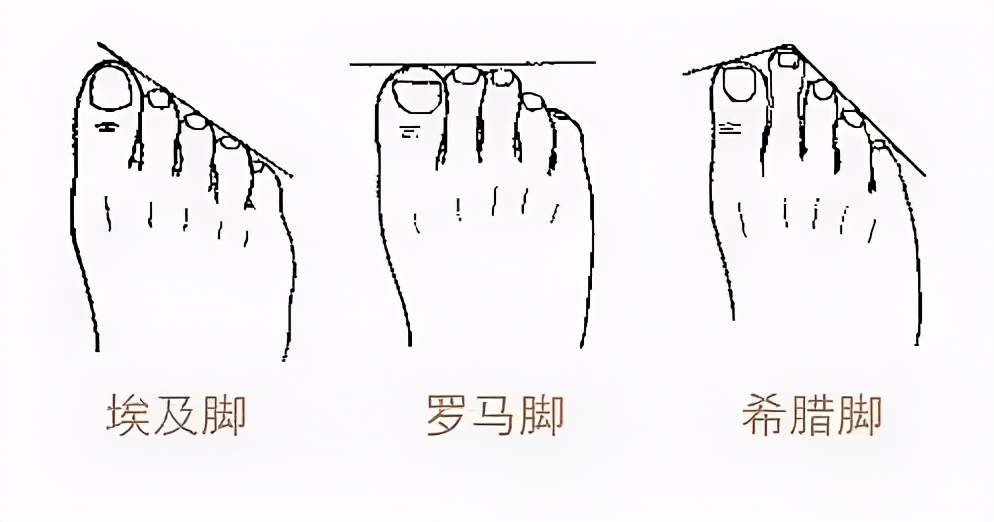 依据脚的长度可分为埃及脚,罗马脚,希腊脚三种▼脚型是第一位.