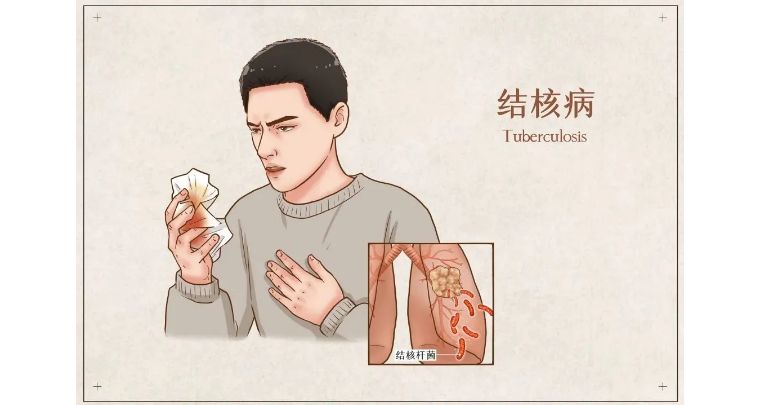 鲁迅,林徽因等众多历史名人在中国更有"十痨九死"的说法肺结核