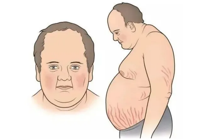 "乳"此尴尬,男子分泌乳汁到底是什么怪病?