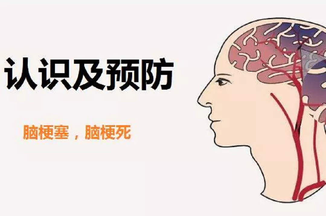 一家三口同时突发脑梗,只因炒菜时爱放一种"东西!__凤凰网