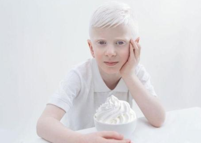 "月亮的孩子"--白化病患者,我们该怎么守护他们呢?