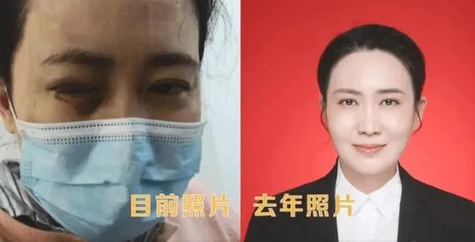 上海助孕联系方式（2020刚过去，那个冲在一线的武汉抗疫女医生，差点就被某私立医院治瞎了眼）