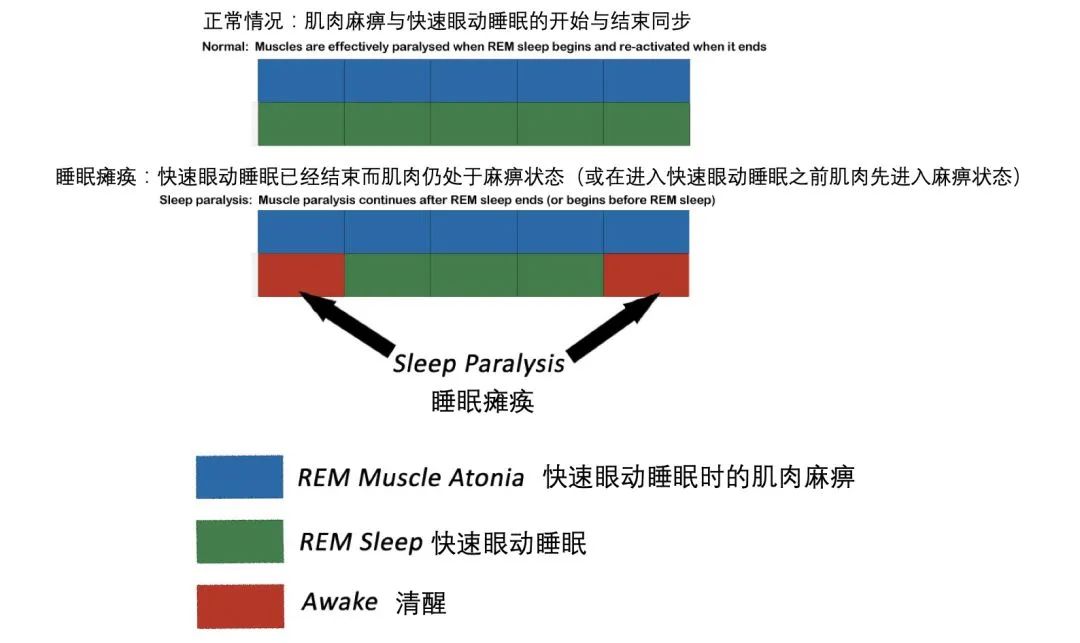 鬼压床是怎么回事（睡觉经常鬼压床是怎么回事）-85模板网