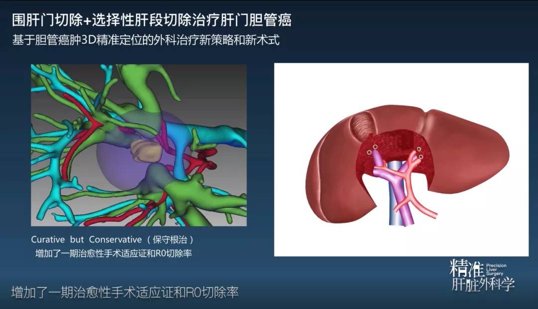 精準外科領域首部鴻篇鉅著《精準肝臟外科學》發佈!iqqa榮登封面