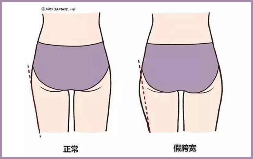 连傅菁的腿都不够完美吗?