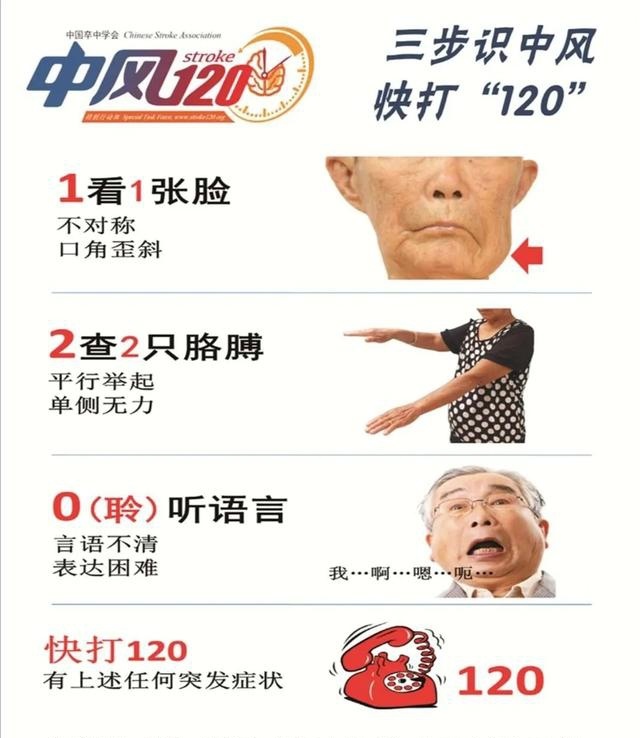 三步识别中风,快打120