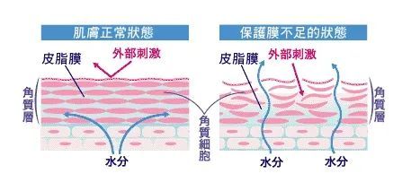 什么是光电治疗光电治疗后皮肤有色沉和返黑？做好术后修复更关键_https://www.jmylbn.com_新闻资讯_第6张