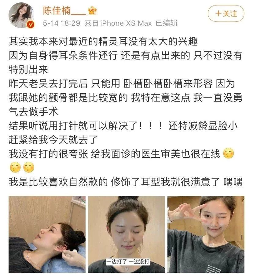 手术床多少钱精灵耳走红失败 医美的钱开始难赚了_https://www.jmylbn.com_品牌排行榜_第11张