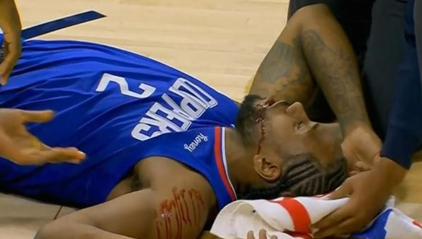 戴面罩有什么影响?莱昂纳德各项数据下滑,被伊巴卡肘击缝8针