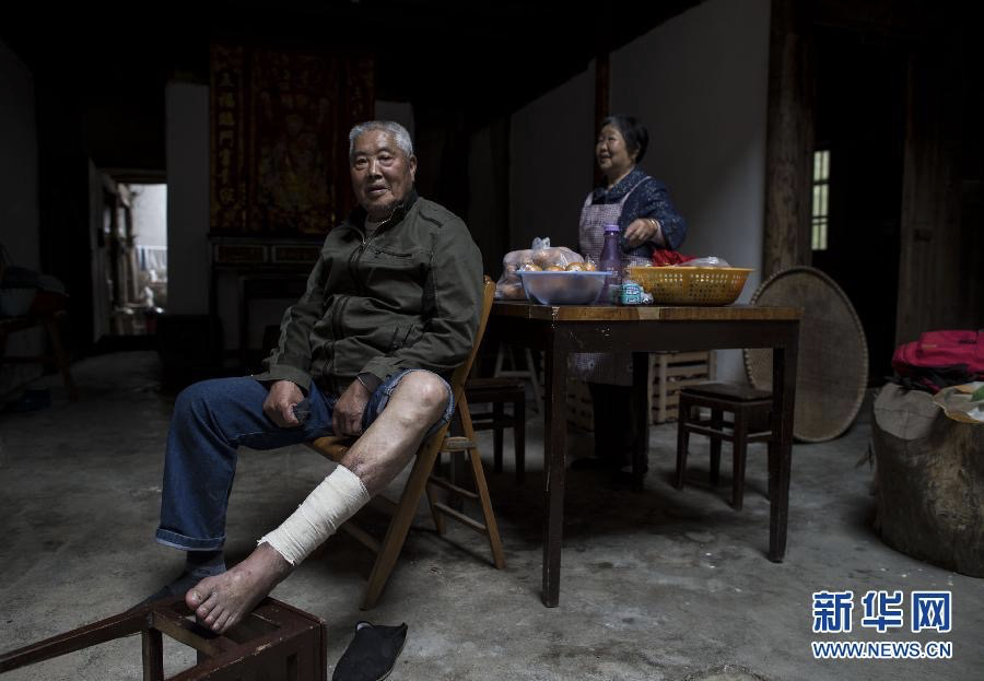 皮肤溃疡焦痂,器官坏死溃烂,致死率高后遗症大……侵华战争中,曾经被