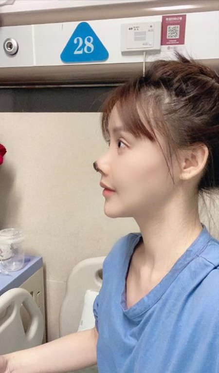 网络演员高溜整容失败,还要巨额还债__凤凰网