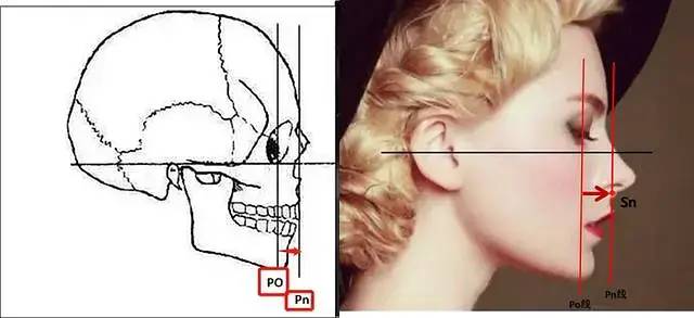 h平面是经过眼眶中点(or)和耳屏中点(p)的一个侧平面.