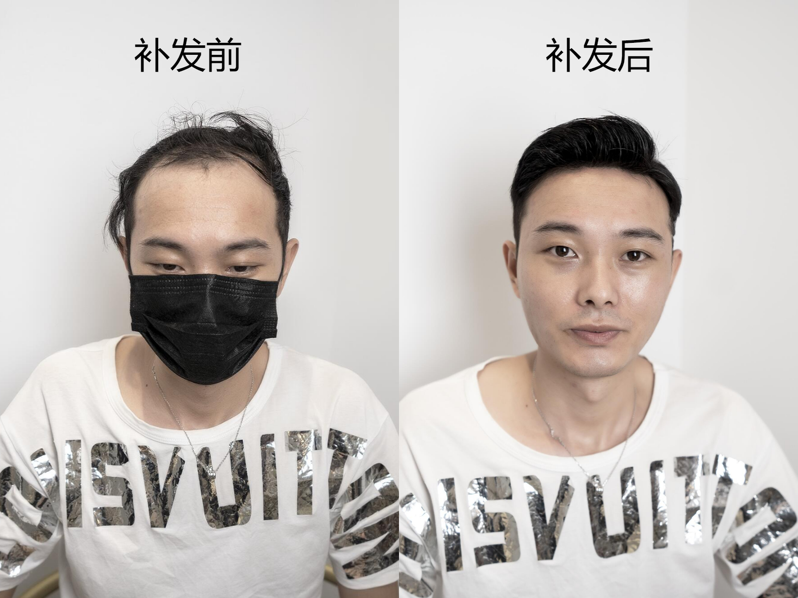 这个方法就是补发了,我们先来看看这些补发前后对比吧~其实针对这些