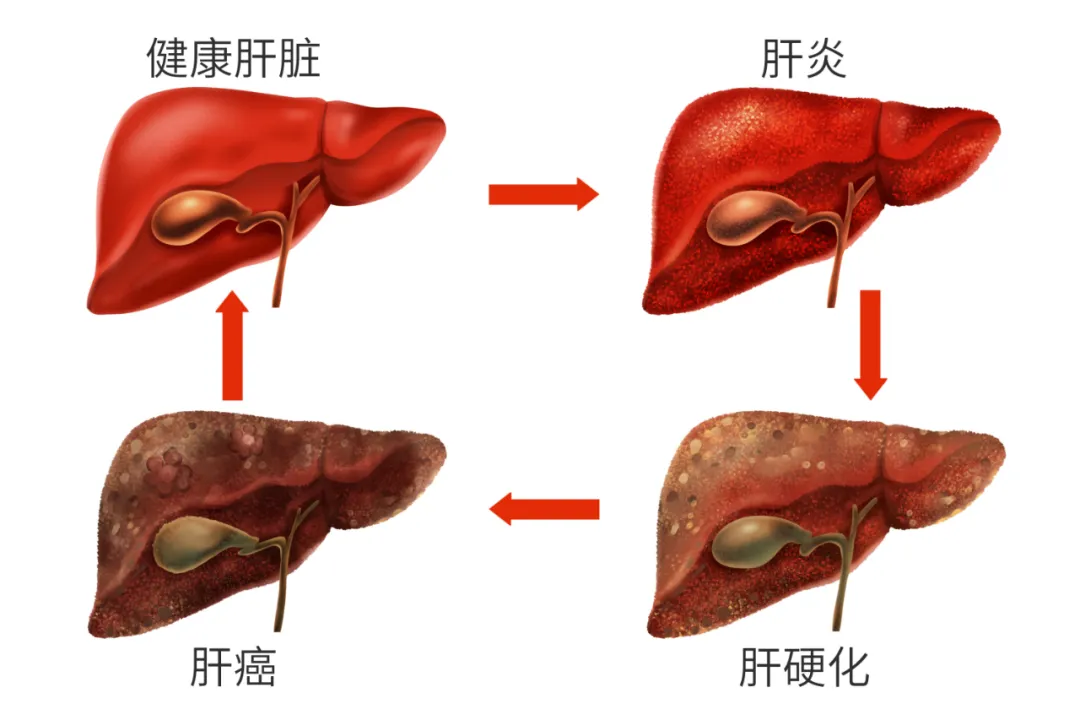 【企鵝杏仁】這種癌症,一發現就是晚期,每小時殺死95人!