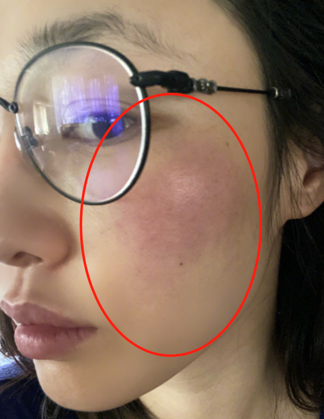 白百何发晒伤自拍照 镜头拉近后皮肤瑕疵明显