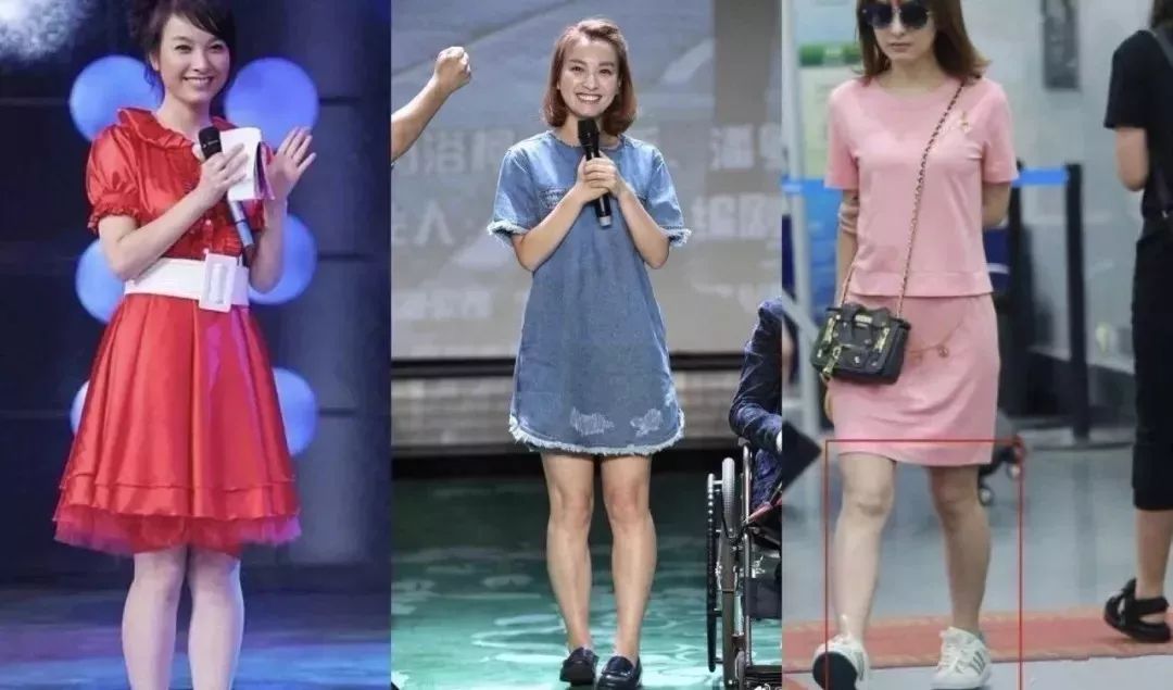 吴昕出道11年被群嘲,36岁却靠美腿"沸腾"娱乐圈:女人美不美,还是要看