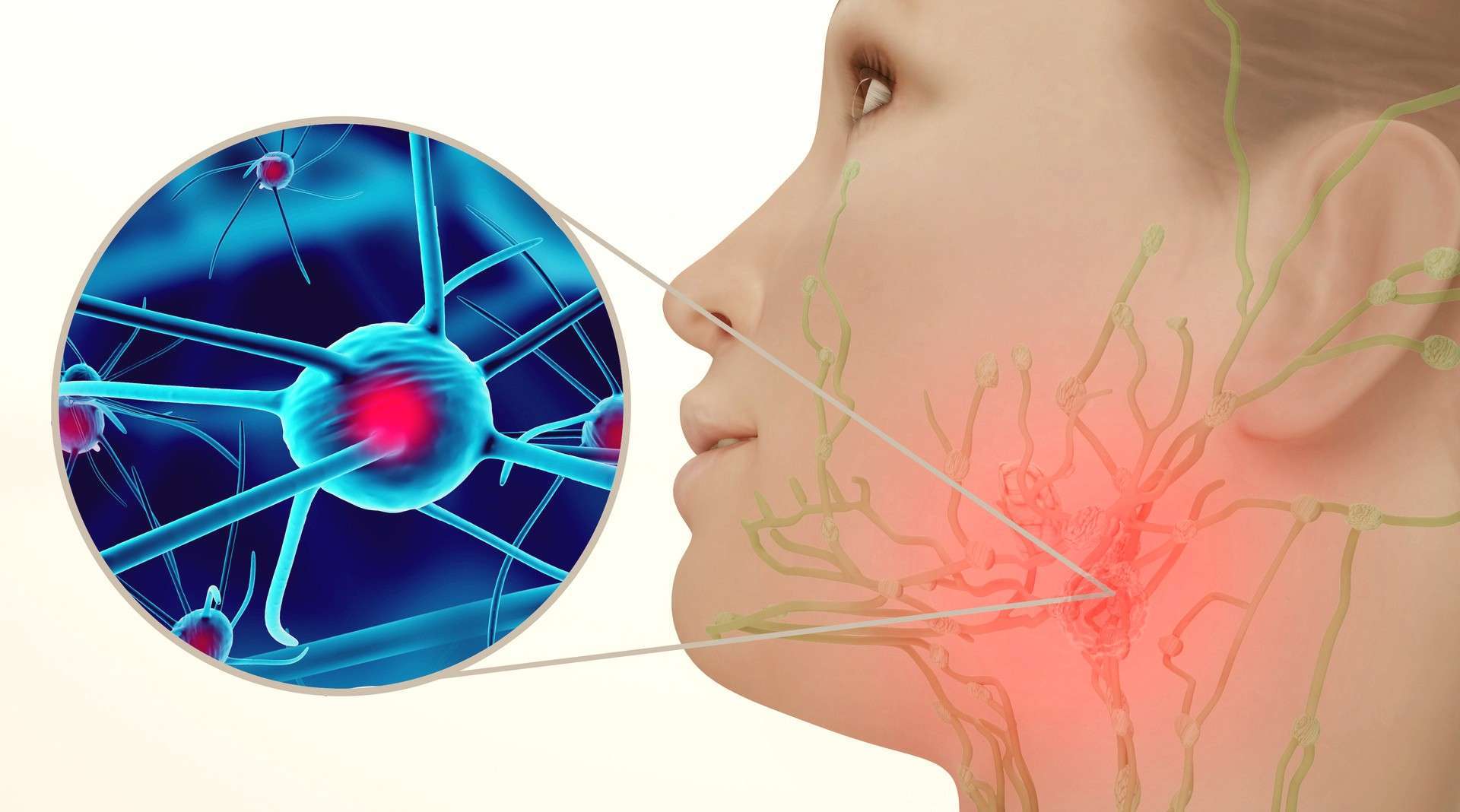 治愈率高但年均花费15万——霍奇金淋巴瘤__凤凰网