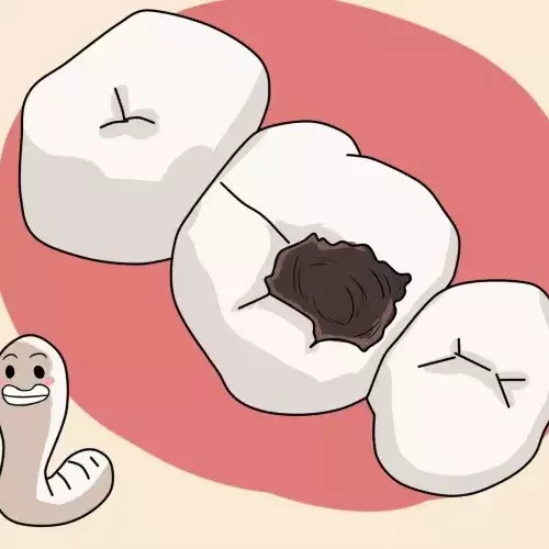 口内细菌繁多,牙齿易变黄变黑