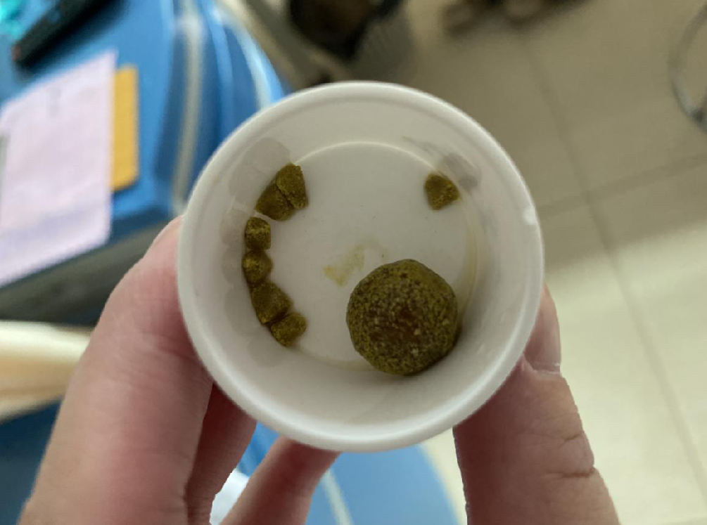 就医检查后了解到是患有胆囊结石,吊水消炎后情况有所好转,吴阿姨对此