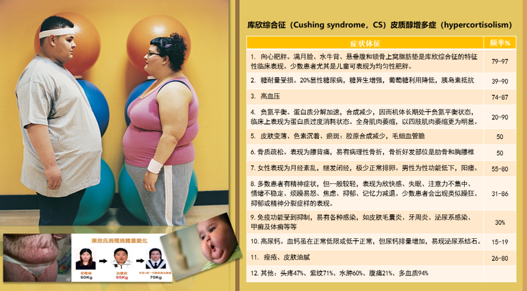 库欣综合征(cushing syndrome,cs)又称皮质醇增多症(hypercortisolism