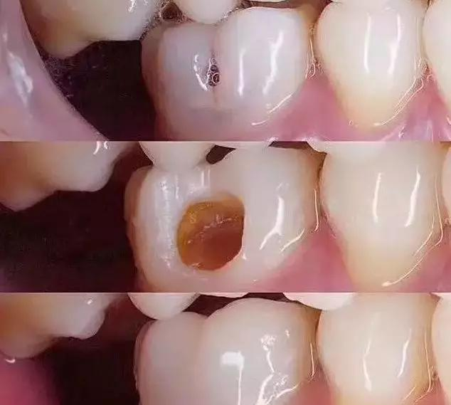 深圳补牙科普-补牙的基本要求__凤凰网