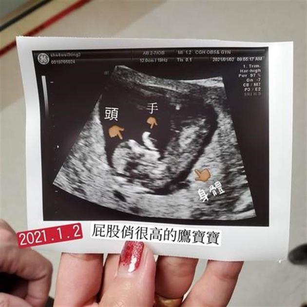 初期怀孕单子 伪造图片