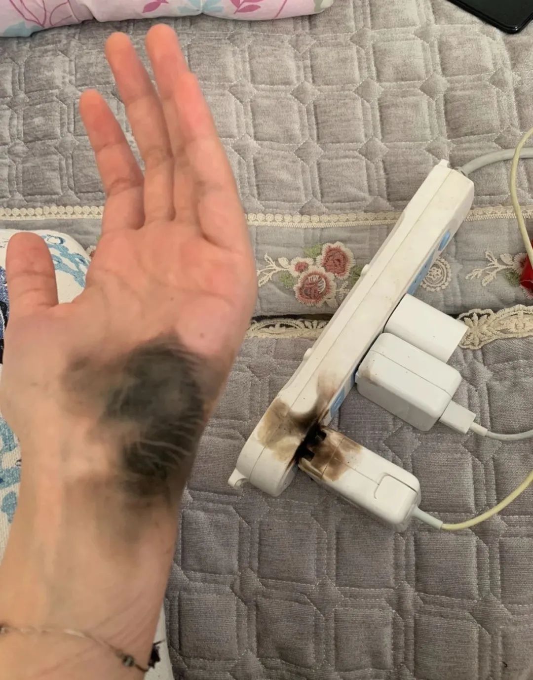 女子拔插头引发爆燃手被炸黑原因竟是