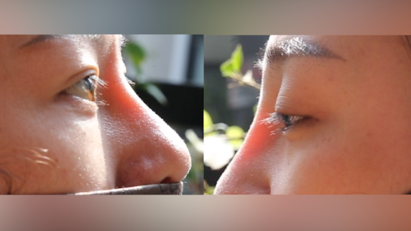 315调查|透光的鼻子,无证的医生,租来的手术室