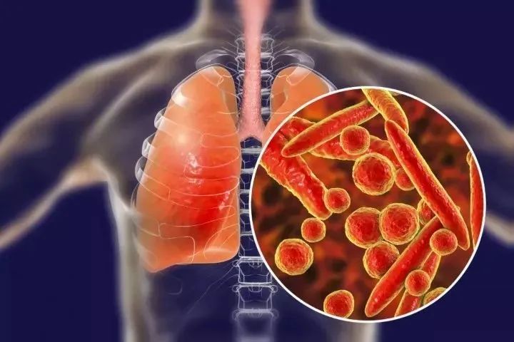 孩子支原体感染就得用抗生素?不妨试试这些方法__凤凰网