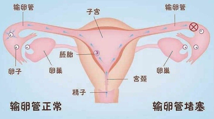 成都供卵试管（患有不孕不育的男性女性需要做什么检查）