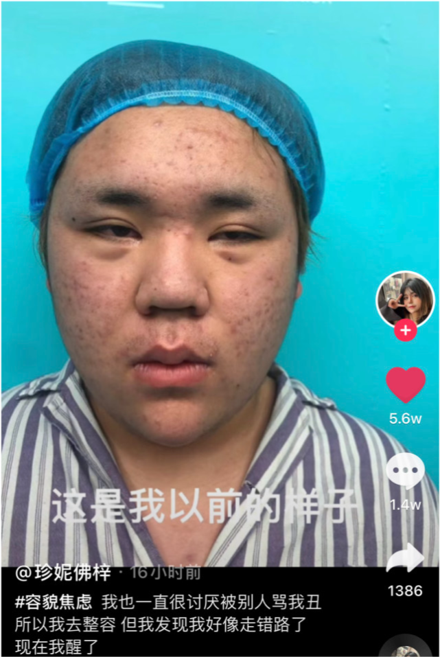 男网红被骂丑后沉迷整容,晒整容前照片拒绝容貌焦虑却要切胃减肥
