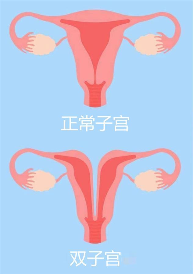 人体子宫形态图片